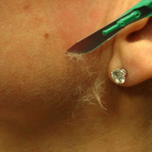 Dermaplaning Single Treatment – Add to any Facial