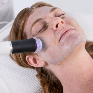 Co2Oxy Facial – Single Treatment