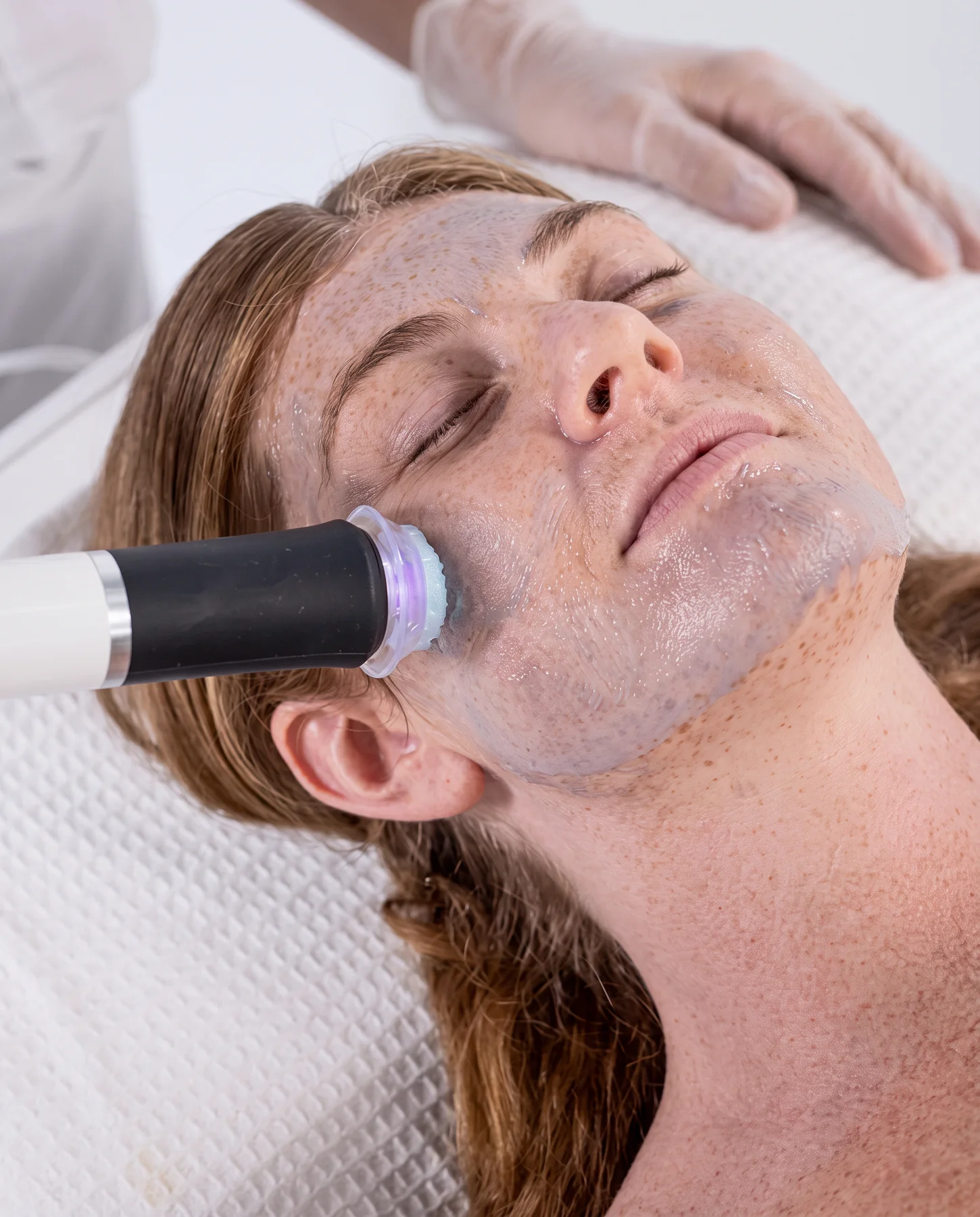 A guest resting with eyes closed as a handheld treatment device is guided slowly along the cheek during a precision facial session at ESSpa Kozmetika
